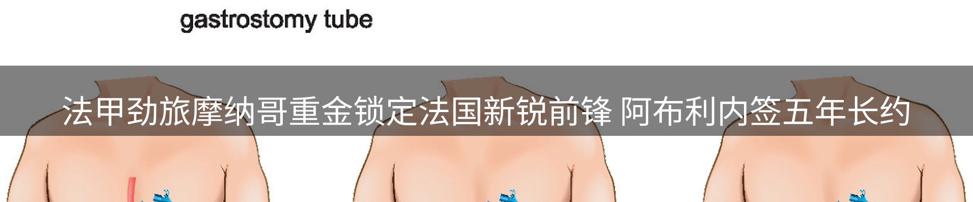 新闻中心